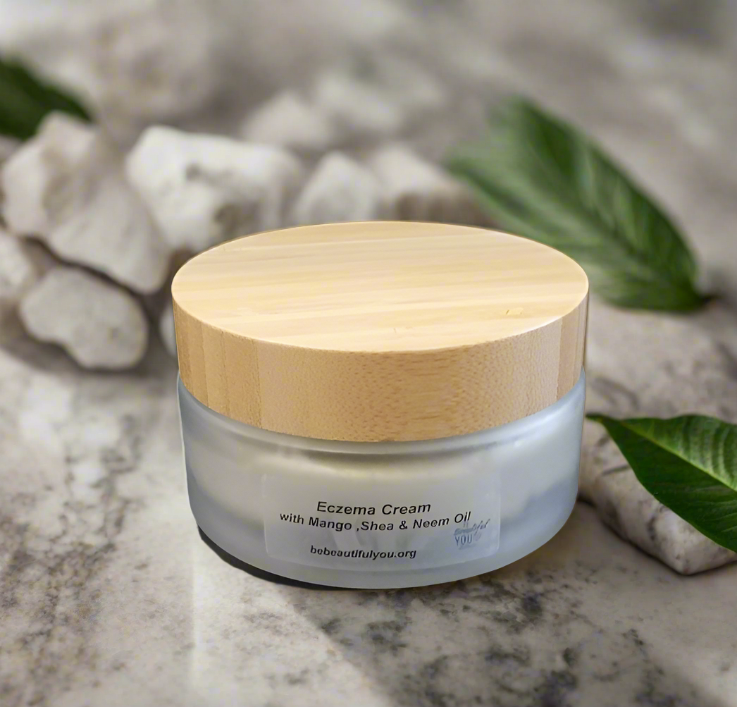 Homemade Eczema Cream